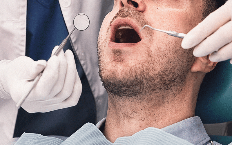 Segundo o INCA, 5% a 10% das leucoplasias podem evoluir para câncer, enquanto as eritroplasias apresentam risco de malignização de até 50%