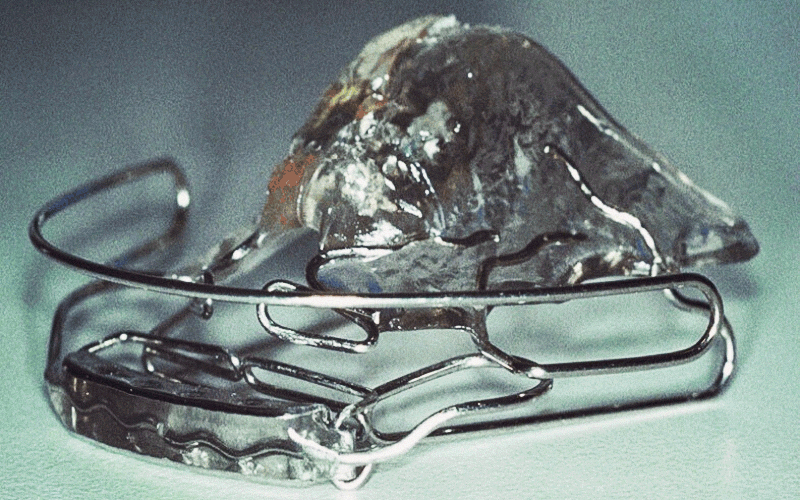 Entre os objetivos do tratamento estão alcançar um plano oclusal paralelo ao Plano de Camper, reabilitar dinamicamente a mastigação e favorecer a respiração buco-nasal